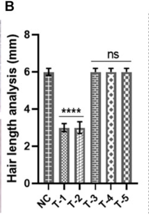 This analysis measures how long the hair grew in skin samples from different treatment groups, including the group treated with the experimental gel (T-3). There was a big difference in hair growth between the NC group and T-1 and T-2. There was no noticeable difference between the NC group and T-3 (the group treated with the experimental gel) or other treatment groups