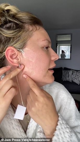 In a recent post, which has been viewed more than 6.6 million times so far, the influencer revealed her secret: she used transparent tapes to lift her cheeks