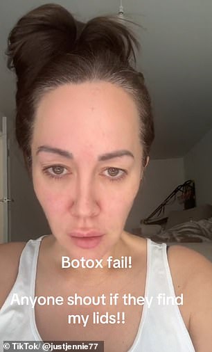 Social media user @justjennie77 shared her Botox accident on TikTok to warn others about the possible side effects. The video shows her revealing her slightly droopy eyelids, which she says is a dramatic change from her previously 