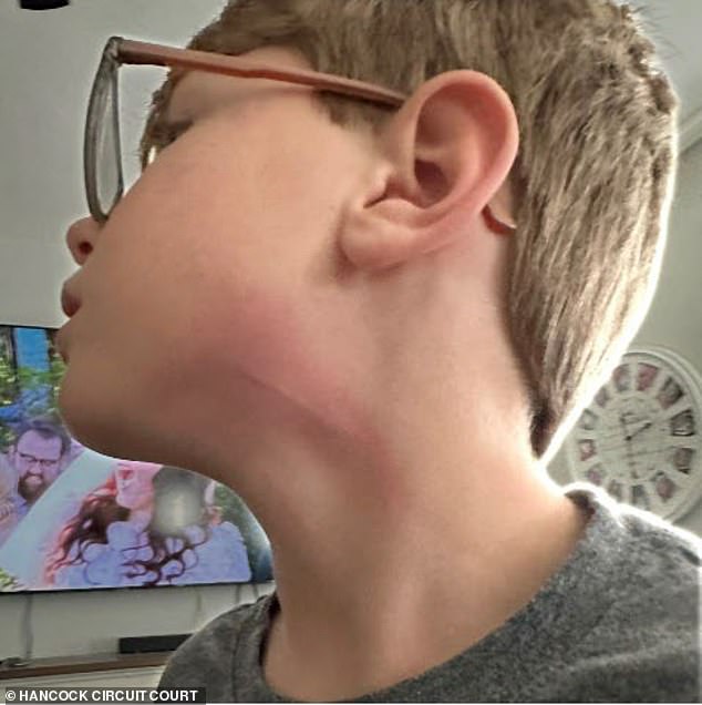 The lawsuit includes photos of injuries Sammy suffered at the hands of bullies