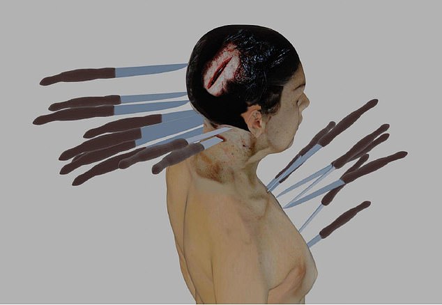 This image shows knife wounds Ellen suffered to her neck and chest, which punctured her brain and severed her spinal cord