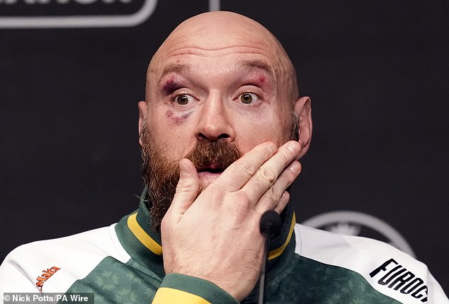 Fury claimed afterwards that he had won both of his fights against the Ukrainian this year