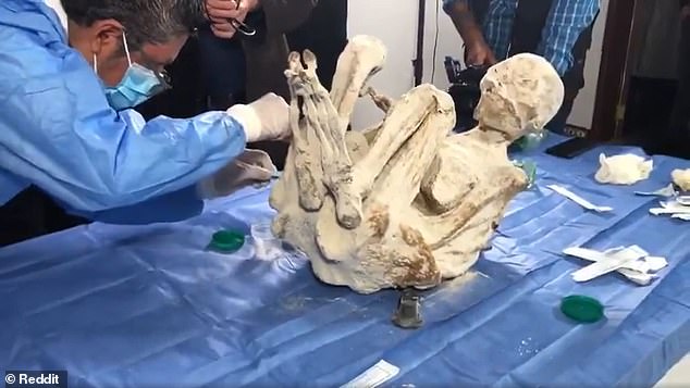 The mummies were recently analyzed by Dr. David Ruiz Vela, former president of the Peruvian Medical Association, who determined that they have human-like organs with visible brain structure.