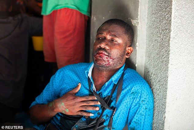 An injured man sits with his back against a wall after gunmen opened fire on a group of journalists gathered for a government press conference on Tuesday