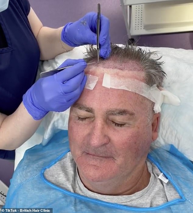 Keys, 67, was photographed undergoing a hair transplant at the British Hair Clinic over the summer