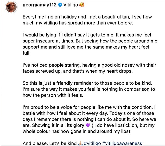 After a holiday to Egypt in May, the Strictly Come Dancing runner-up shared a photo of her hands and uploaded a lengthy post urging people to be kind