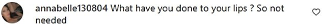 Almost immediately, negative comments poured in, as trolls wrote: 'What have you done to your lips? So not necessary