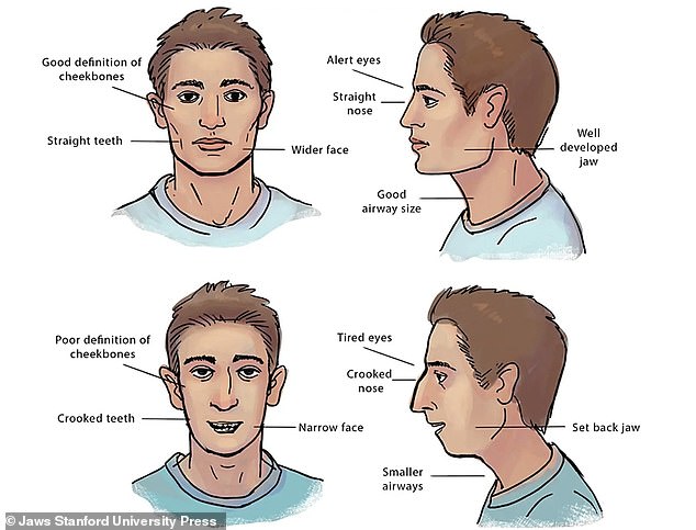 The top images show a nose breather, the bottom one a mouth breather. According to Dr. Huberman's colleagues Sandra Kahn and Paul R. Ehrlich, who published the book Jaws, mouth breathing can cause a set back jaw and eye strain.