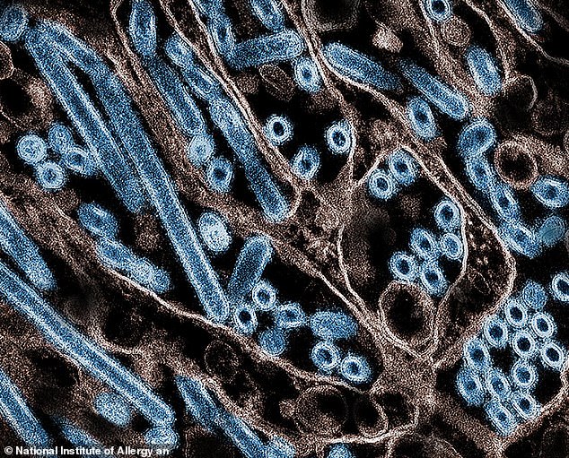 So far, 61 confirmed cases of H5N1 human infection have been reported in the US in 2024, following a widespread outbreak on bird and livestock farms in the United States