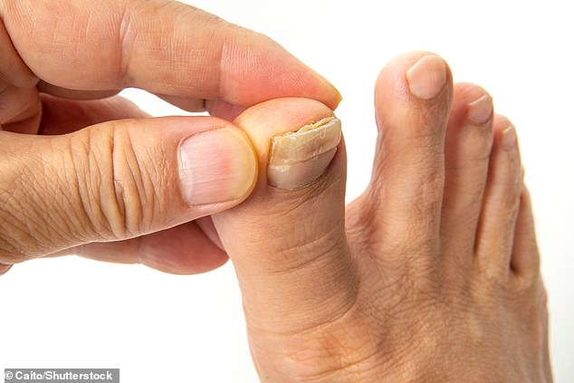 In general, there is a lack of official advice on what to do with toenail clippings (file photo)