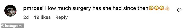 In the years since she fell while walking her dogs and received multiple stitches, the Grammy winner's followers on social media have called her 