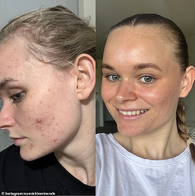 Customer Tianna shared her stunning skin transformation after using esmi skincare products and said 'consistency' and a 'simple skincare routine' are the 'secrets' to a flawless glow