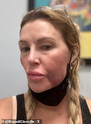 The former Real Housewives of Beverly Hills star has shown off the shocking changes to her face