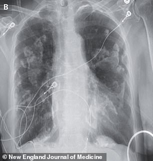 This image is a scan of the lungs of today's patient