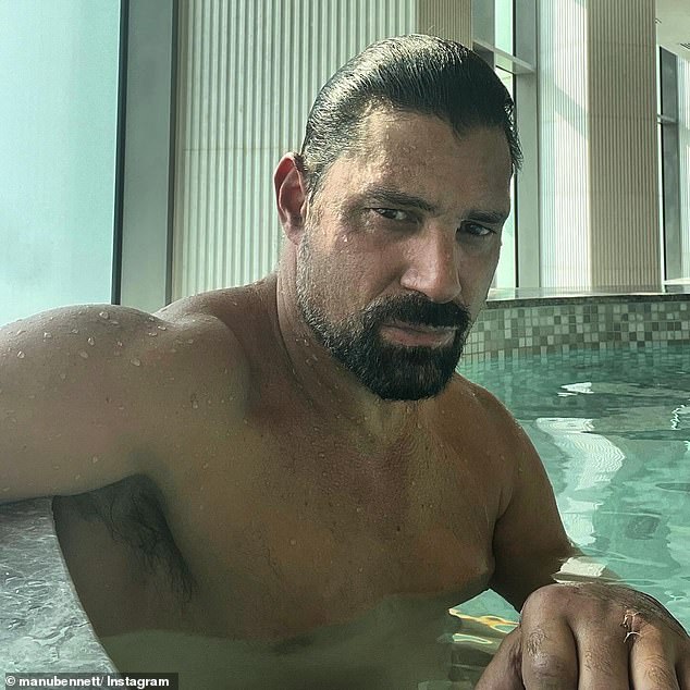 Manu Bennett has revealed how a horror dune buggy accident 'took out' his hand and left him needing multiple operations and stitches, months after the crash