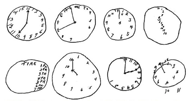 The Clock Drawing Test relies on the patient remembering what a clock face looks like – a skill known as executive function, which involves the way we plan, organize and complete tasks