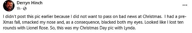 On Facebook, Derryn revealed he had fallen a few days before Christmas, but waited until Boxing Day to reveal his injuries as he didn't want to share 'bad news' over the festive period.