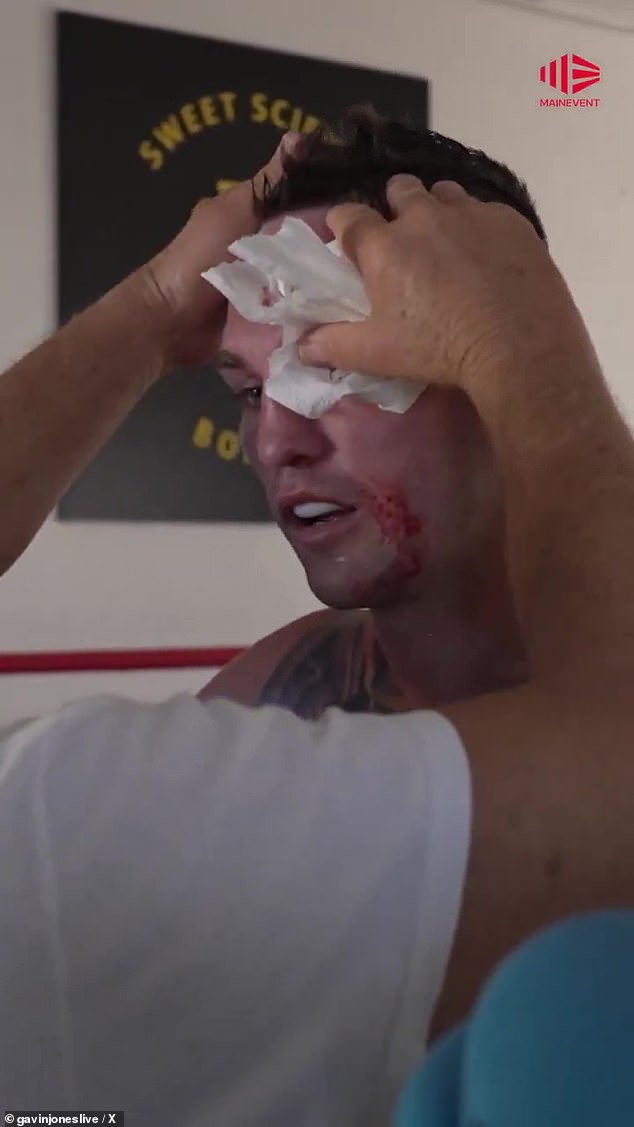 Australian fighter Sam Goodman has had to postpone his world title shot after suffering a cut above his eye during training