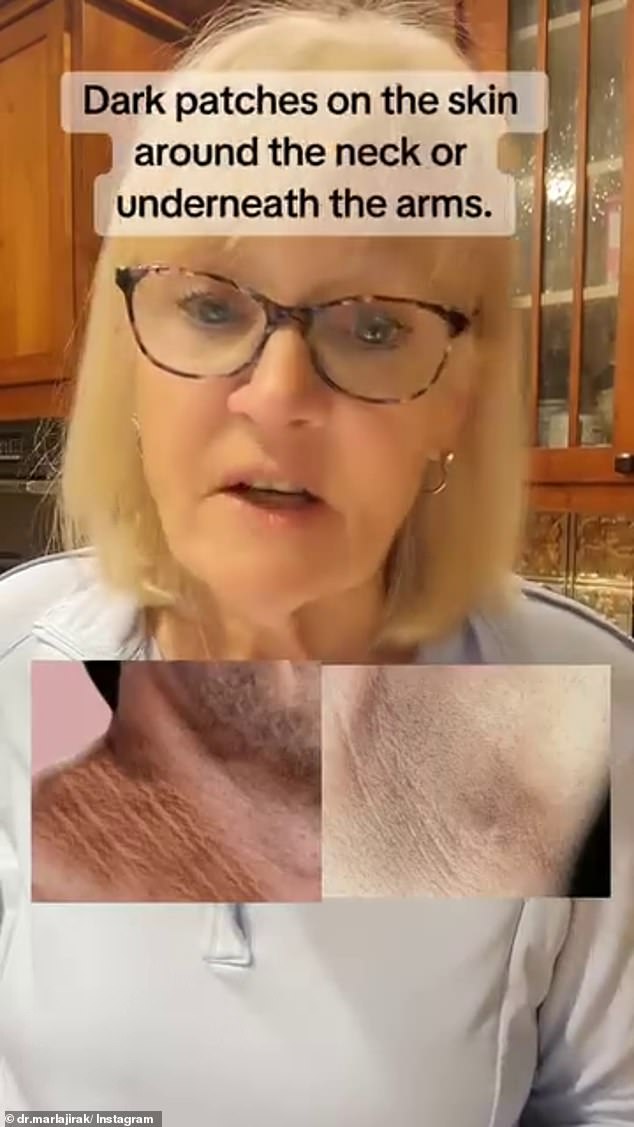 Dr. Marla Jirak, a PhD lecturer and researcher in the fields of health, stress management and behavior change, took to TikTok to list symptoms that could indicate a pre-diabetic body