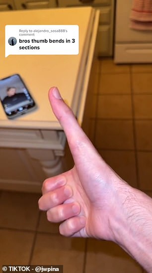 Mr. Pina has gone viral on TikTok for his thumb, showing clips comparing it to other objects. The photo above shows him trying to use his cell phone with his thumb extended