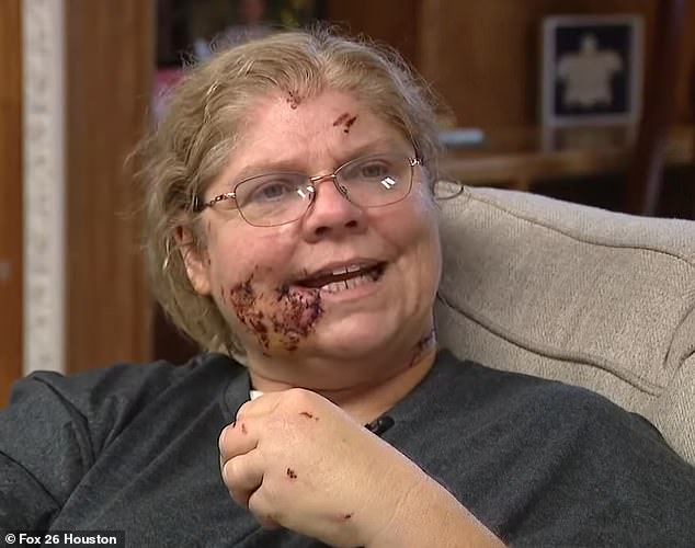 Michelle Means, 52, has revealed how she thought she was about to die when she was attacked by her neighbour's eight pit bulls, leaving her with horrific injuries to her arms and face.