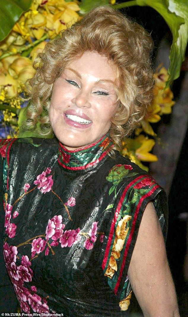 Jocelyn, seen here in 2003, claimed to have had Botox only twice in her life