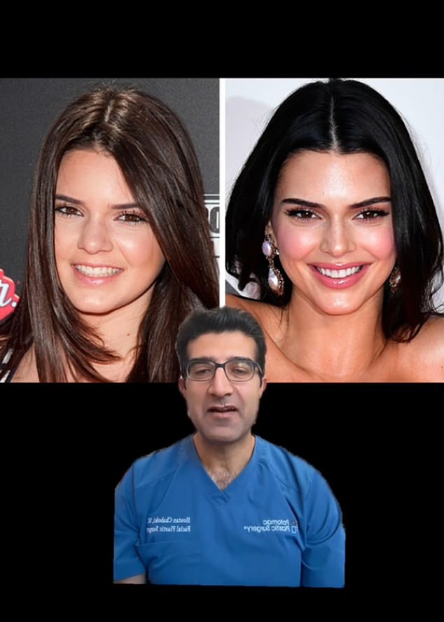 Dr. Houtan Chaboki, a Washington plastic surgeon, said he suspects Kendall has had a nose job and lip filler. In a TikTok video, he said he was 