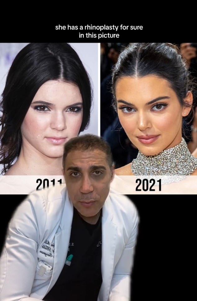 Dr. Saul Lahijani, a plastic surgeon at the Beverly Hills Institute of Plastic Surgery, told his 15,000 TikTok followers, “Her eyebrows are higher, her eyes are more open. She did a little fox eye, maybe with the brow lift.”