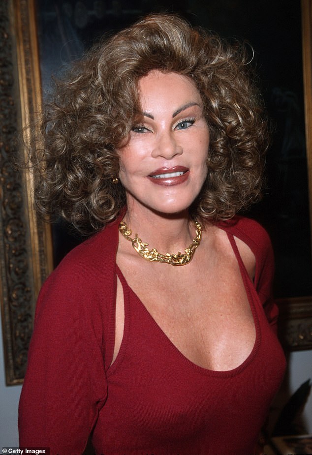 She was nicknamed Catwoman for her slanted cat-like eyes and lion-like facial features, and it was reported that she began undergoing cosmetic procedures after marrying Alec N. Wildenstein in April 1978 (seen in 1999)