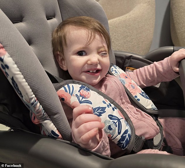 Lily, 1, is pictured after her first day of chemotherapy to shrink the tumors in her right eye. Doctors think there is a good chance they can save it