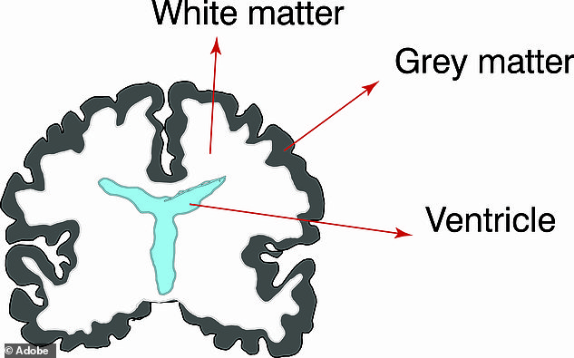 Gray matter is usually found in the outermost layer of the brain, or cortex, and plays a major role in mental functions such as memory, emotions and information processing. Meanwhile, the white matter, the lighter tissue towards the center, speeds up the signals between the cells