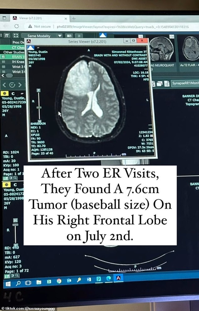 Aggressive malignant brain cancers have an overall average life expectancy of 12 to 18 months with treatment