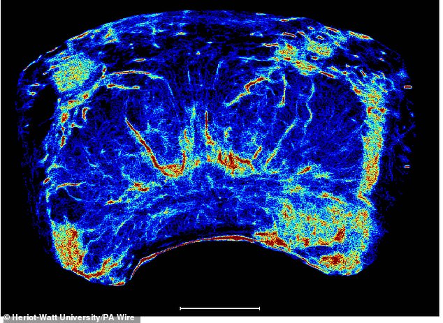 Prostate cancer imaging, developed by university researchers, has shown 