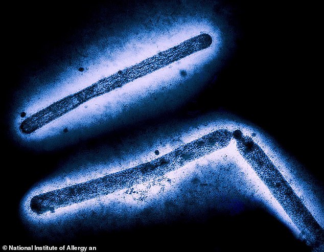 A scan of the virus that killed an elderly man in the US state of Louisiana on Monday