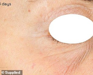 Impressive: the powerful formula reduces fine lines and wrinkles in just 30 minutes. One user saw visible results after using the product for a period of 28 days