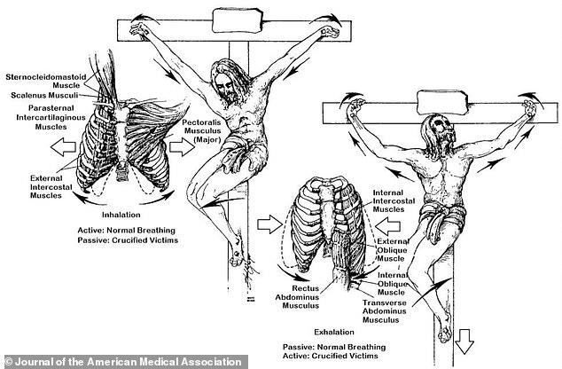 A 1986 study determined that Jesus died of asphyxiation from exhaustion