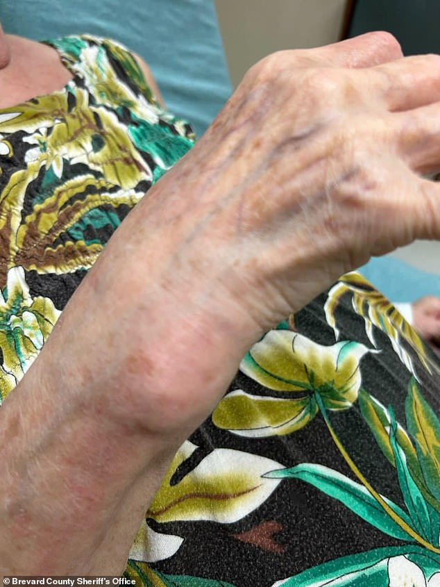 The ordeal left the elderly victim with a swollen wrist due to the physical violence associated with the alleged theft