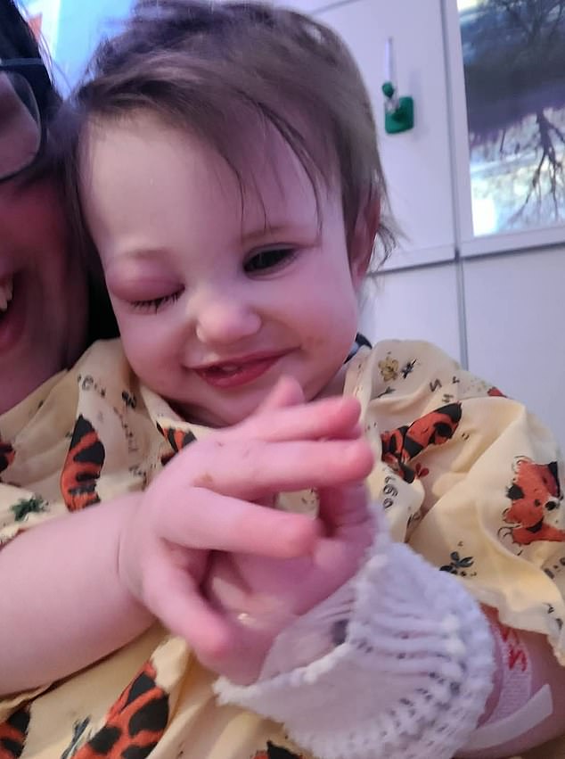 Lily is pictured in St Jude's. There, her parents learned that a tumor the size of a golf ball was pressing on her left eye, which needed to be removed