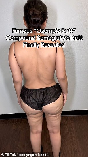 “What does an ozempic/semaglutide butt look like?,” she also wrote. 'You guessed it? loose skin and cellulite (nothing to brag about, results vary)'