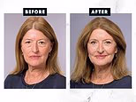 How I fixed my saggy, tired-looking under-eye bags in just TWO HOURS. I hated how I looked at 62 and no amount of sleep or makeup was going to help, until I tried this incredible method: KATH BROWN