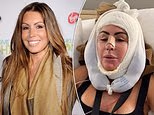 Rachel Uchitel, 51, gets an extreme plastic surgery makeover to return to her 'younger' self... see her now