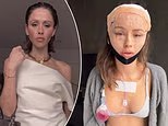 Mother-of-three Ruby Tuesday Matthews has been accused of being a terrible influence on young women after she got a Korean facelift at the age of 33