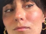 I have suffered from cold sores for 40 years. They always made me feel sick and dirty... until I found the solution. Now I no longer have to hide when someone rears their ugly head