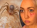 How to survive America's most dangerous spider: They're spreading across the US - and you often only feel them when a wound opens and your urine turns black. Here they hide in houses... and what to do immediately after a snack