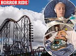 Two women are both seriously ill in hospital with shaved heads after the Six Flags X2 roller coaster left them with brain damage, report says