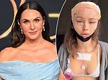 Laura Byrne targets influencers like Ruby Tuesday Matthews after she got a facelift at the age of 33: 'I don't want this world for my daughters'
