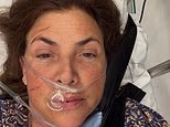 Kirstie Allsopp reveals she was taken to hospital by air ambulance to undergo surgery after a nasty fall during her family holiday