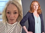 I loved winding down with a few glasses of wine every evening - until I was diagnosed with liver disease at the age of 47. I gave up alcohol for a year and lost three stone - but this is how I REVERSE my condition