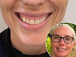 My gummy smile always made me hide from photos or stop smiling - until I found the five-minute solution. It's something I swore I would NEVER do... but it finally makes me grin again