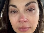 I thought sleeping with makeup on wouldn't hurt. Now I have this terrifying condition that affects 1 in 5 people. Doctors say it's too late for me: I will suffer this pain all my life. Don't make my mistake